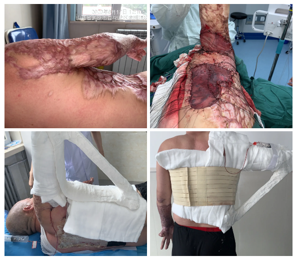 1594975045215738.png image.png