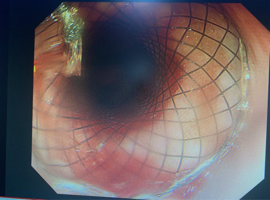 1616405151825669.jpg 支架.jpg