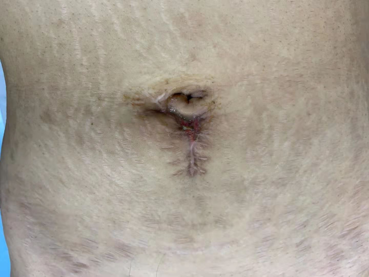 1617261184903284.jpg 2222.jpg