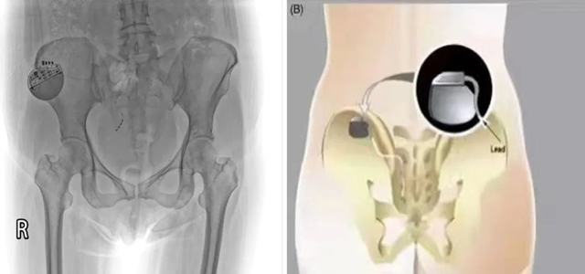 1708418343652967.jpg 1.jpg