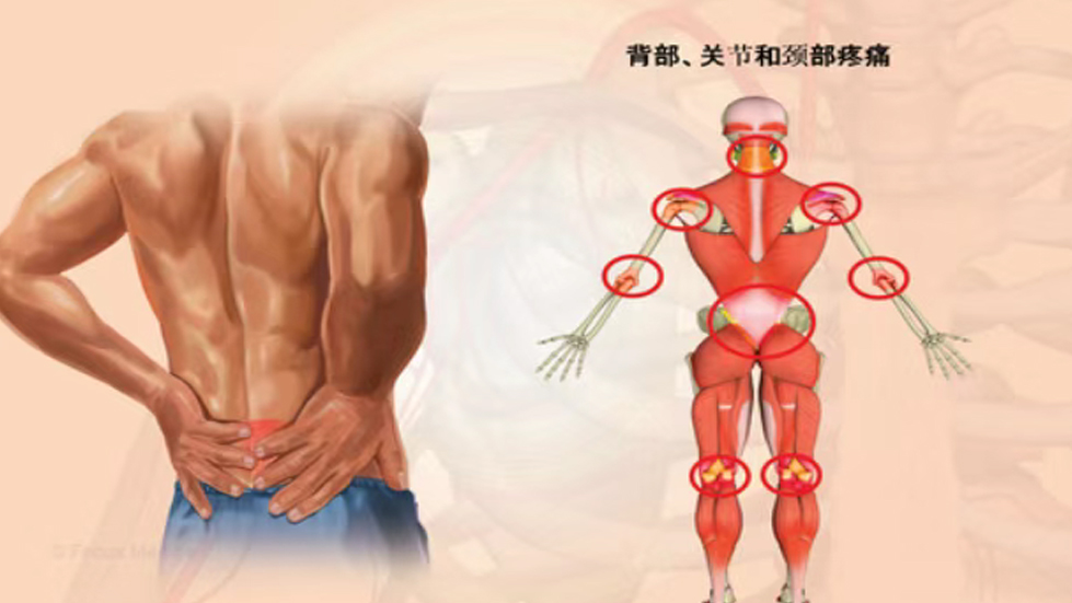 太原市第七人民醫(yī)院康復(fù)醫(yī)學(xué)科門診特色手法技術(shù)介紹——意大利筋膜手法